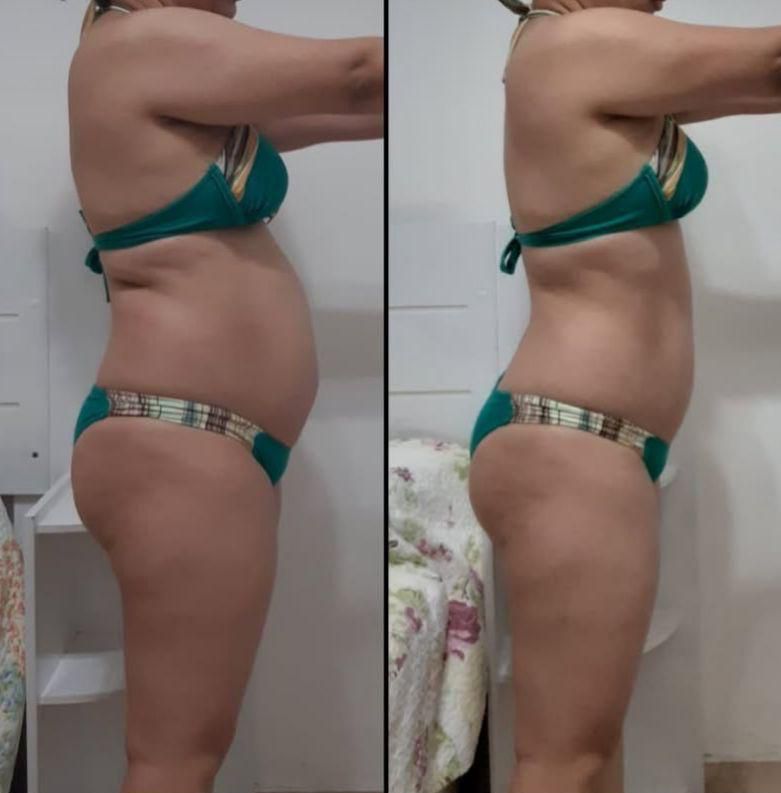 Transformación antes y después 1