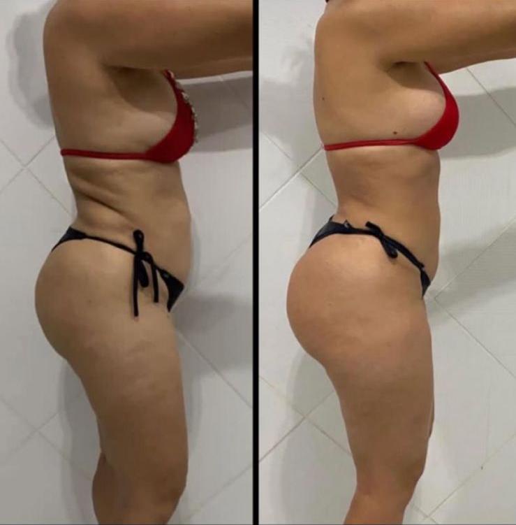 Transformación antes y después 2