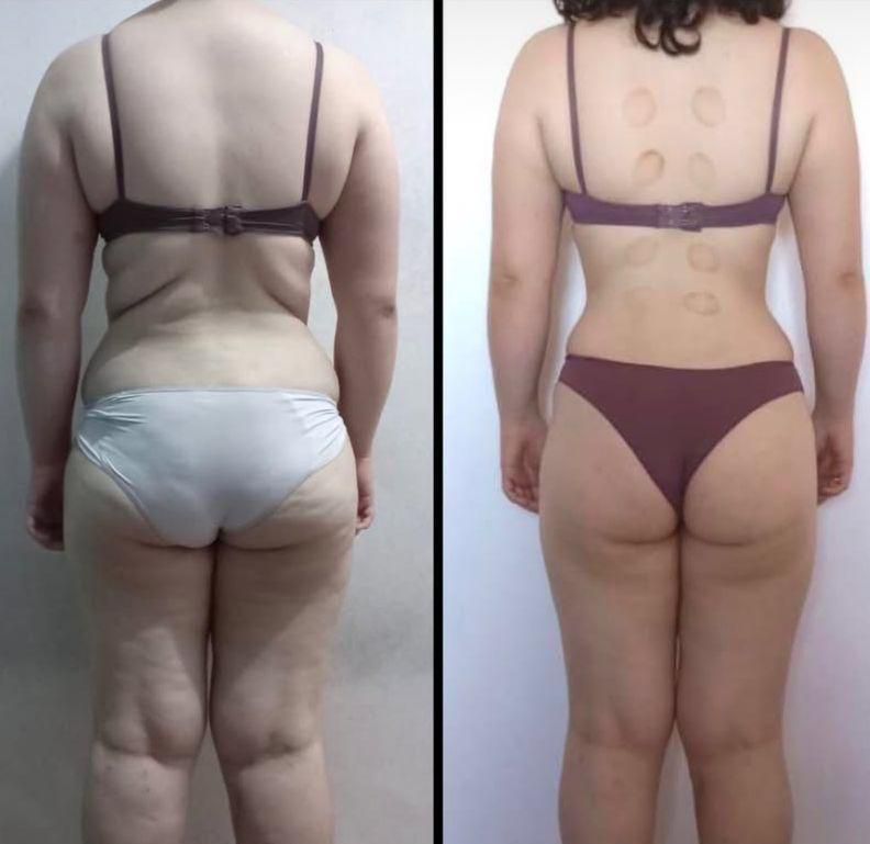 Transformación antes y después 3