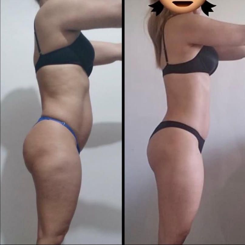 Transformación antes y después 4