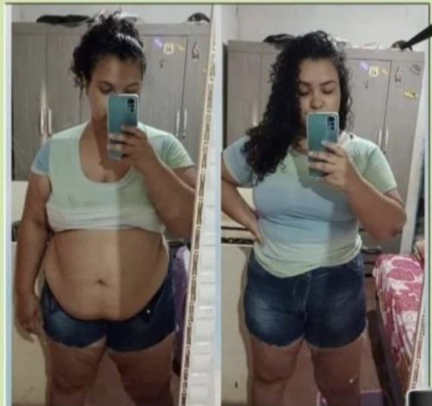 Transformación antes y después 6